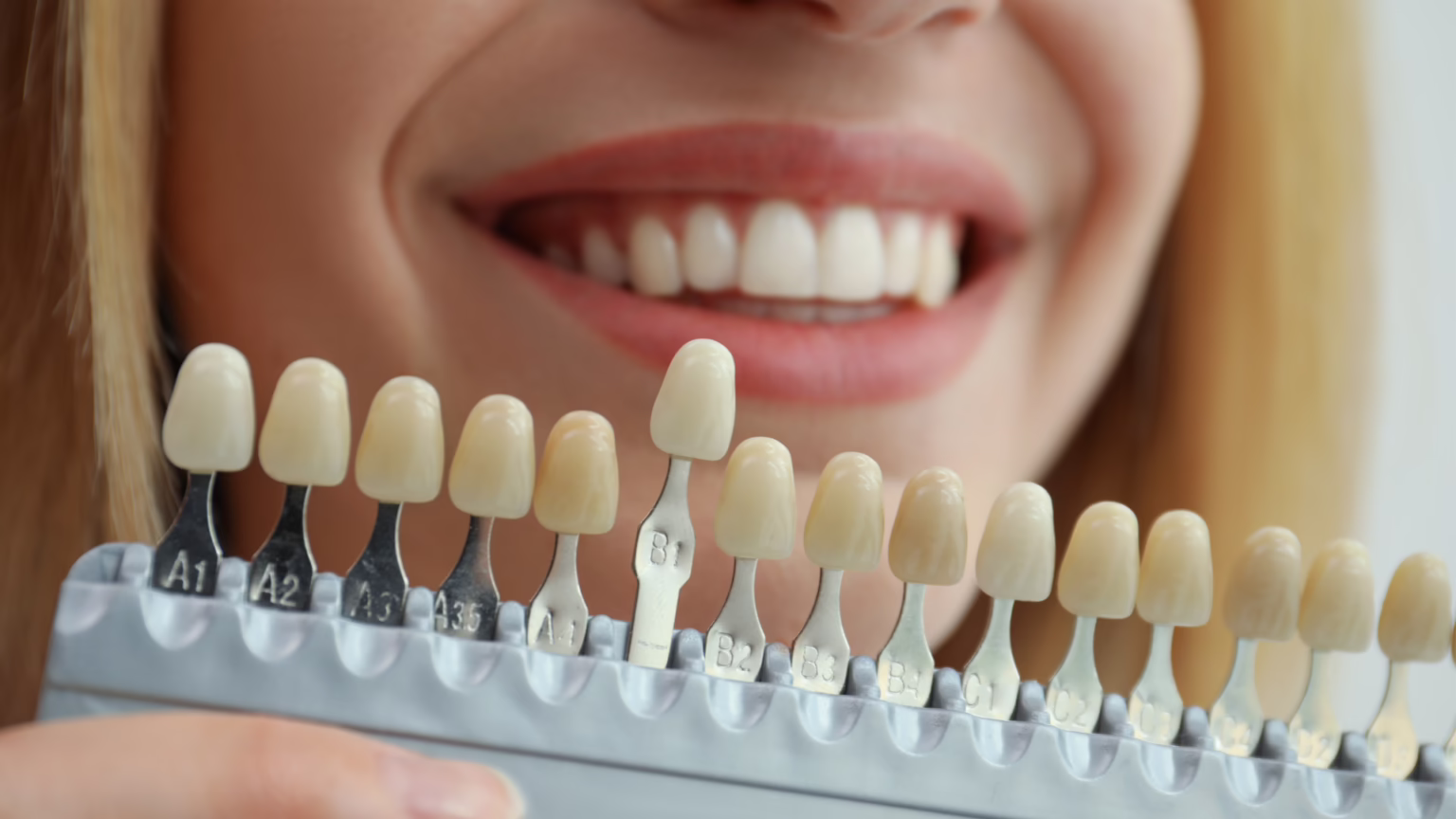 What Are the Different Types of Cosmetic Dentistry?