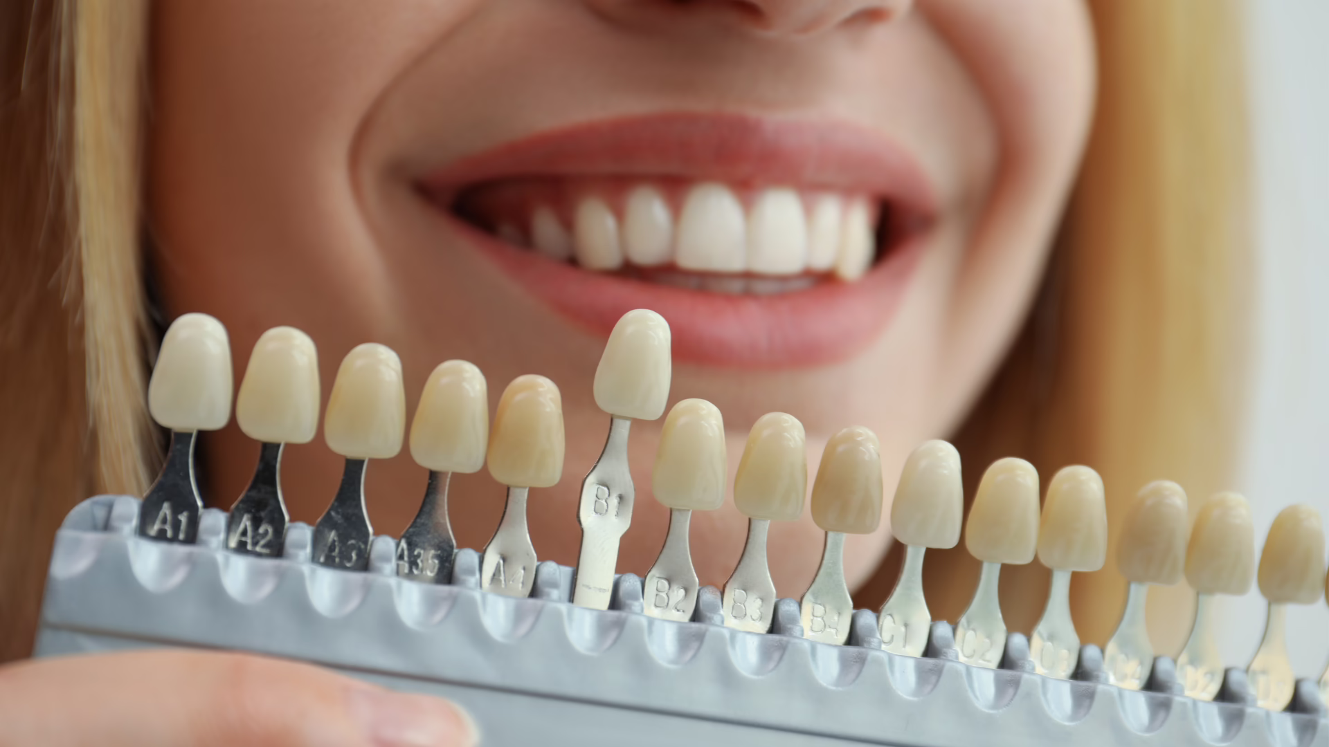 What Are the Different Types of Cosmetic Dentistry?